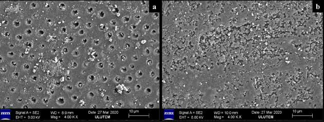 . SEM image analysis. a; Sound dentin, b; Caries-affected dentin (4.00 kx magnification).