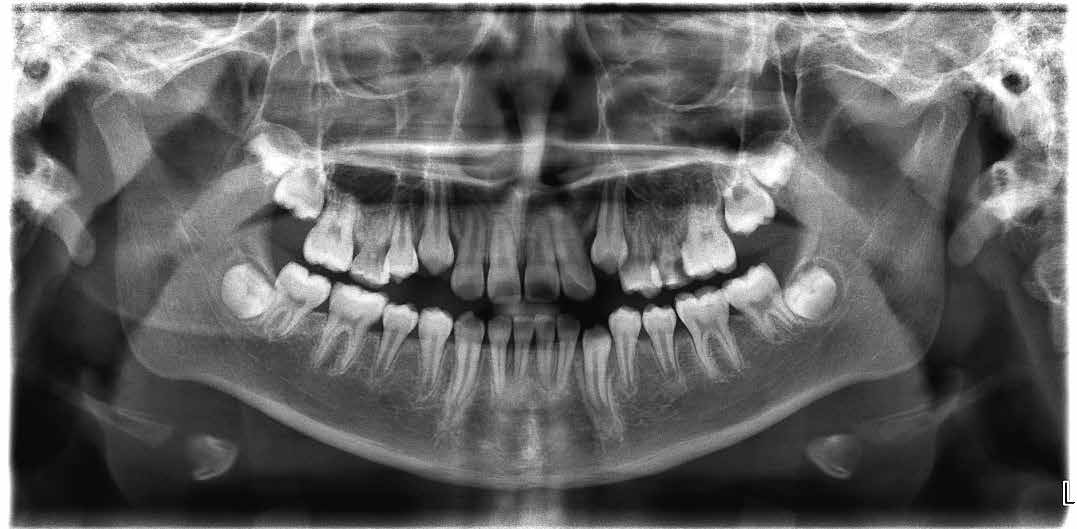 Journal of Clinical Pediatric Dentistry (JOCPD)