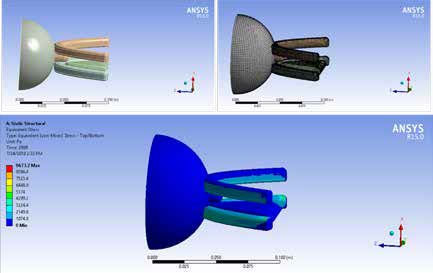 . FEM analysis of Human Nipple from 6 to 12 months