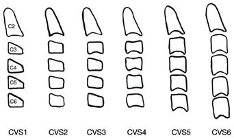 Lamparski analysis.