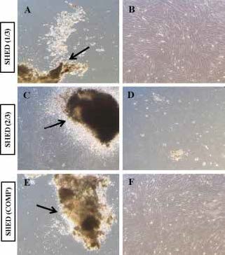 : Primary culture establishment and growth features of SHED. A, C and E. Cells
emerging out from tissue explants during the second or third day after their
placement (arrows). B, D and F. Plastic adherent cells showed proliferation
activity after attaining typical fibroblast-like morphology by day 15 of
culture.) (Images: ×10).