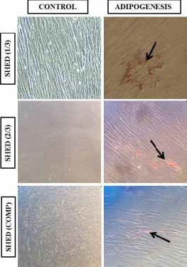 . Adipogenic differentiation of SHED. Cells cultured
in basal medium exhibited with fibroblast-like
morphology. Adipogenic induction was observed by the
accumulation of neutral lipid clusters after 21 days of
culture by oil red O staining (arrows). Many droplets of
lipids were found in a single cell of SHED. (Images: ×20).