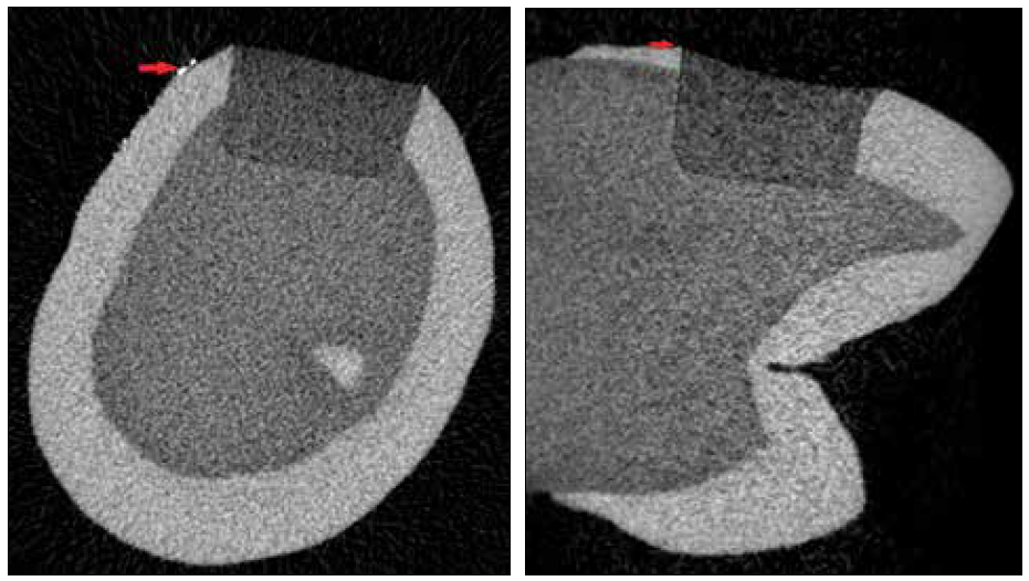 . Cross and axial sections showing no dye penetration-Score 0