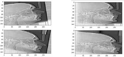 : Examples of data augmentation by randomly flipping and rotating images to multiple angles, width and height shifting and zoom changing