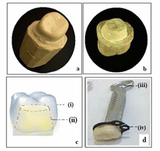 - Steps involved in composite tooth replica for
cementation of zirconium crowns. (a) Gypsum die (b)
Preparation of gypsum die following the guidelines
of crown preparation. (c) Tooth replica made from
composite core-build up material with passive fit of
zirconia crowns (i) PPZC (ii) composite tooth replica.
(d) Sample after cementation (iii) zinc screw (iv) steel
washer.