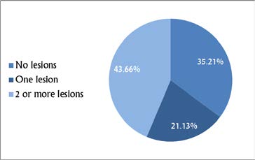 . Prevalence of number of caries lesions present in a
bitewing when a single caries lesion present on the
collateral side.