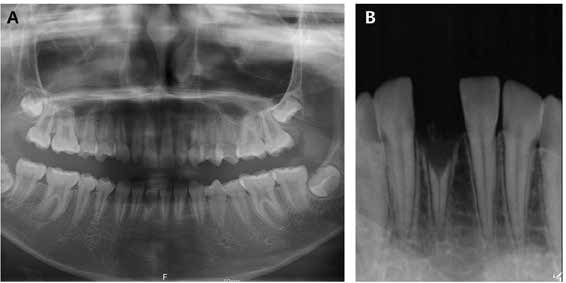 Journal of Clinical Pediatric Dentistry (JOCPD)