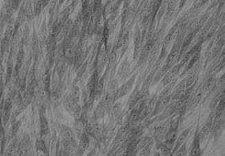 . Untreated Dermal Fibroblasts (DF).