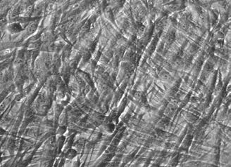 : Dermal Fibroblasts after 1 hour exposure