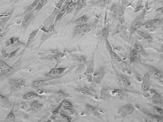 : Dermal Fibroblasts after 2 hour exposure to 0.03%
SDF (600x magnification) to 0.03% SDF (600X
magnification)