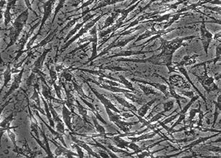 : Dermal Fibroblasts after 4 hour exposure