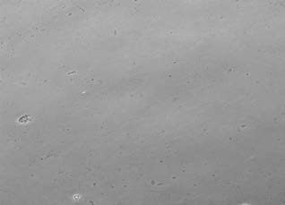 : Dermal Fibroblasts after 8 hour exposure to 0.03%
SDF (600X magnification) to 0.03% SDF (600X
magnification)