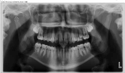 : Radiographic image with ROI.