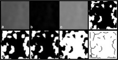 : Stages of fractal dimension analysis a Gaussian blur b Substraction of
the blurred image from the original image c Addition of a gray value of 128
to each pixel location d Binarization e Erosion f Dilatation g Inversion h
Skeletonization.