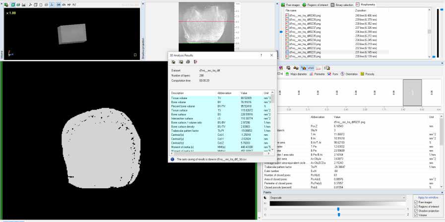 Calculation of mineral density of dentin tissue within
the cavity boundaries using CTAn.