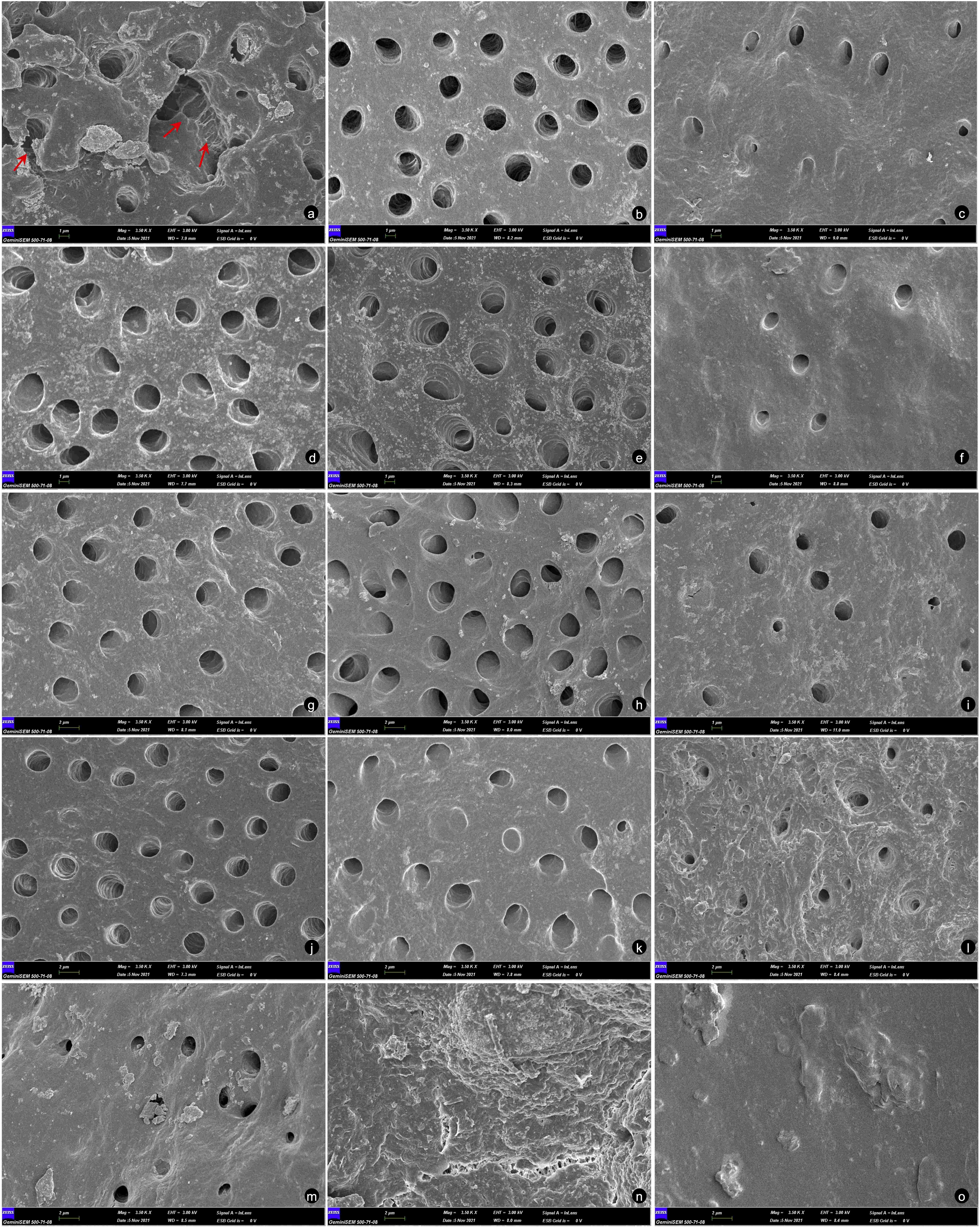 Representative SEM 
images for all the study groups. Representative SEM images for EDTA solution 
applied with OEN (a–c). Coronal third (a, score 0), middle third (b, score 0) 
and apical third (c, score 1) in Group 1. Note the erosive defects in intra- and 
peritubular dentin in coronal third in Group 1 (a) (indicated with red arrows). 
Representative SEM images for CA solution applied with OEN (d–f). Coronal third 
(d, score 0), middle third (e, score 0) and apical third (f, score 1) in Group 2. 
Representative SEM images for EDTA solution applied with DSVN (g–i). Coronal 
third (g, score 0), middle third (h, score 0) and apical third (i, score 1) in 
Group 3. Representative SEM images for CA solution applied with DSVN (j–l). 
Coronal third (j, score 0), middle third (k, score 1) and apical third (l, score 
1) in Group 4. Representative SEM images for NaOCl solution applied with OEN 
(m–o). Coronal third (m, score 1), middle third (n, score 2) and apical third 
(o, score 2) in Group 5.