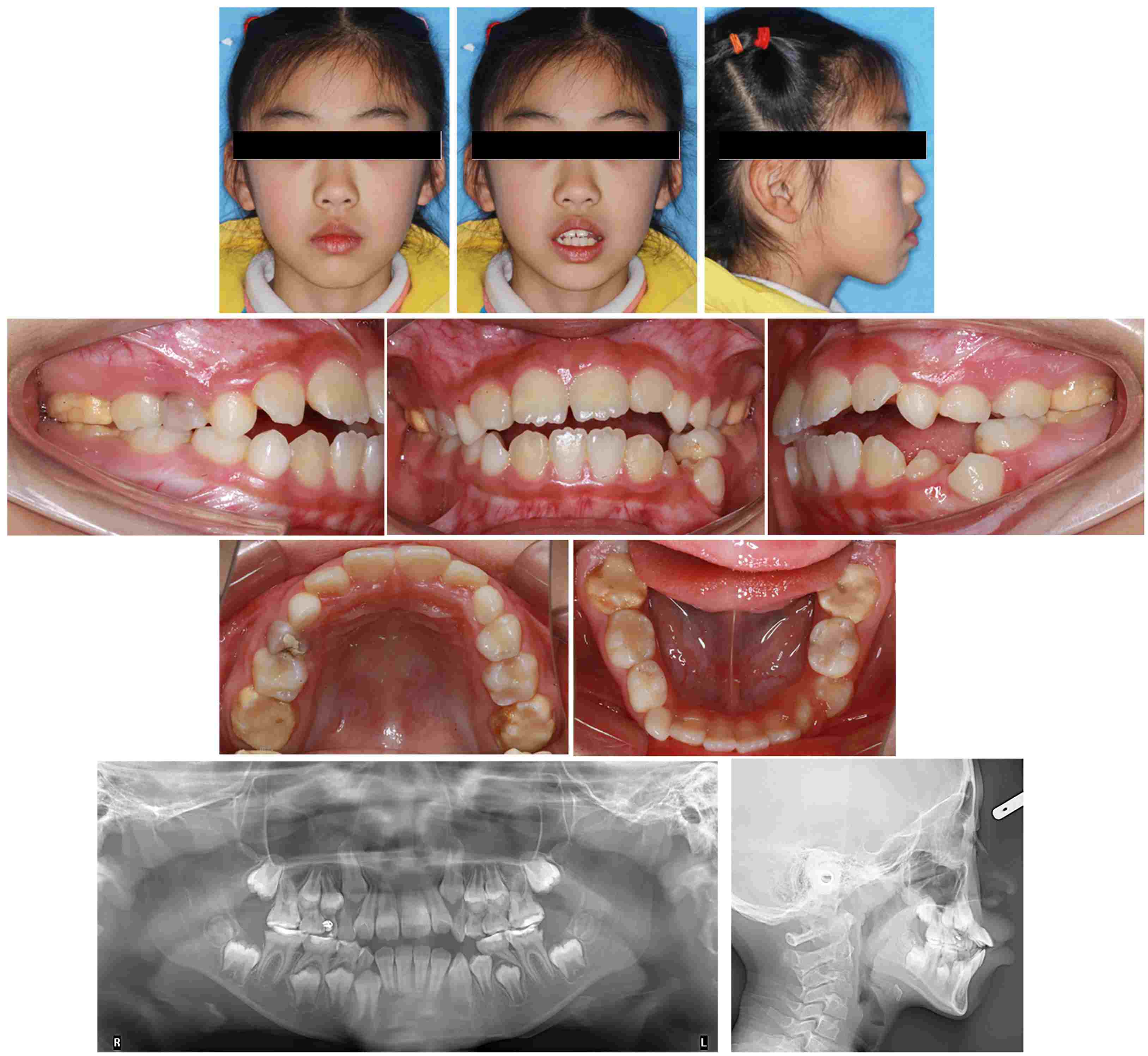 Journal of Clinical Pediatric Dentistry (JOCPD)