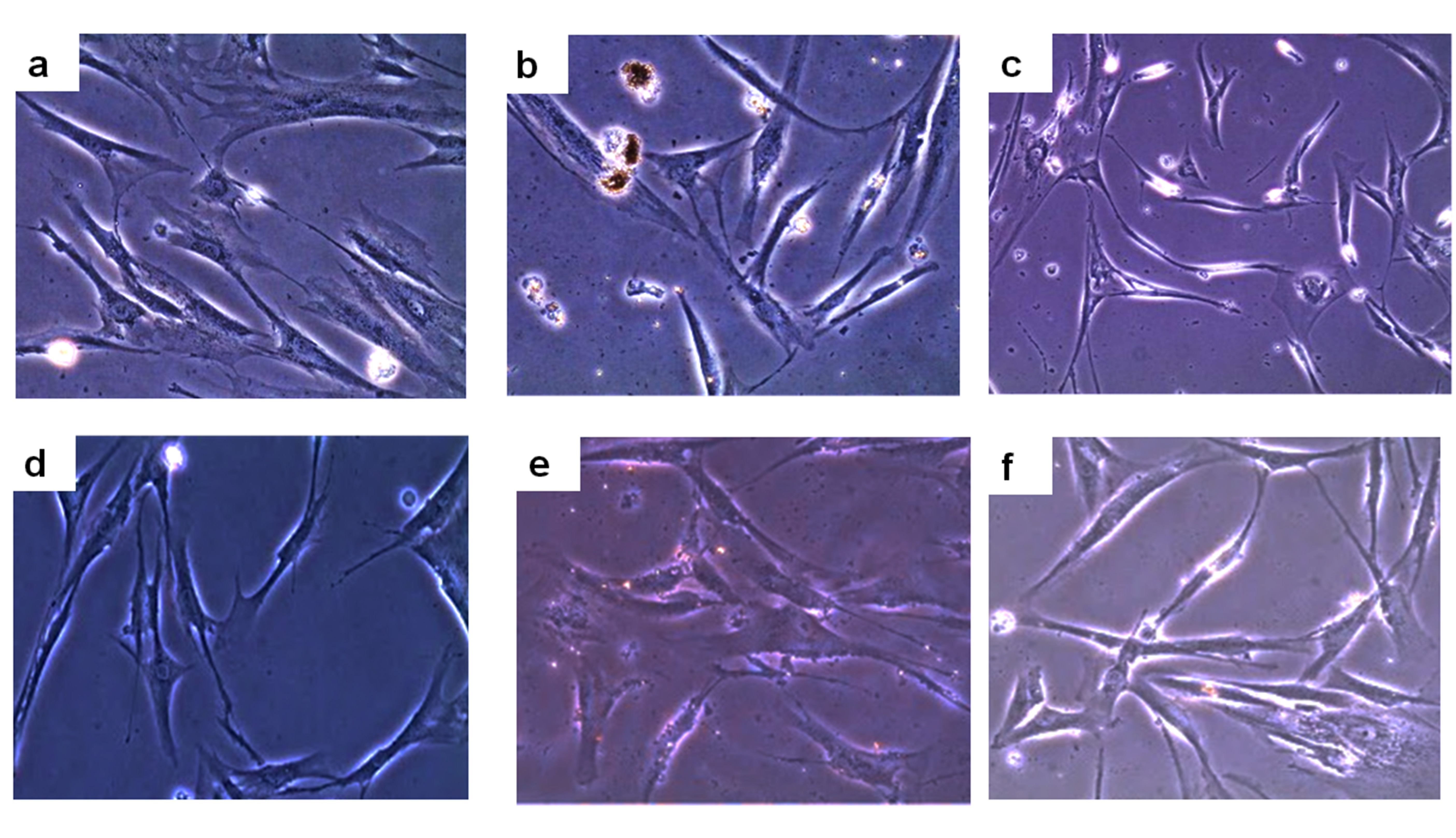 Micrographs 
obtained from optical microscopy (40X) on the morphology of hDPFs after 72 h of 
incubation. control group (a), with Biodentine eluates (b) and MTA (c). After 7 
d of incubation: control group (d), with Biodentine eluates (e) and with MTA 
eluates (f).