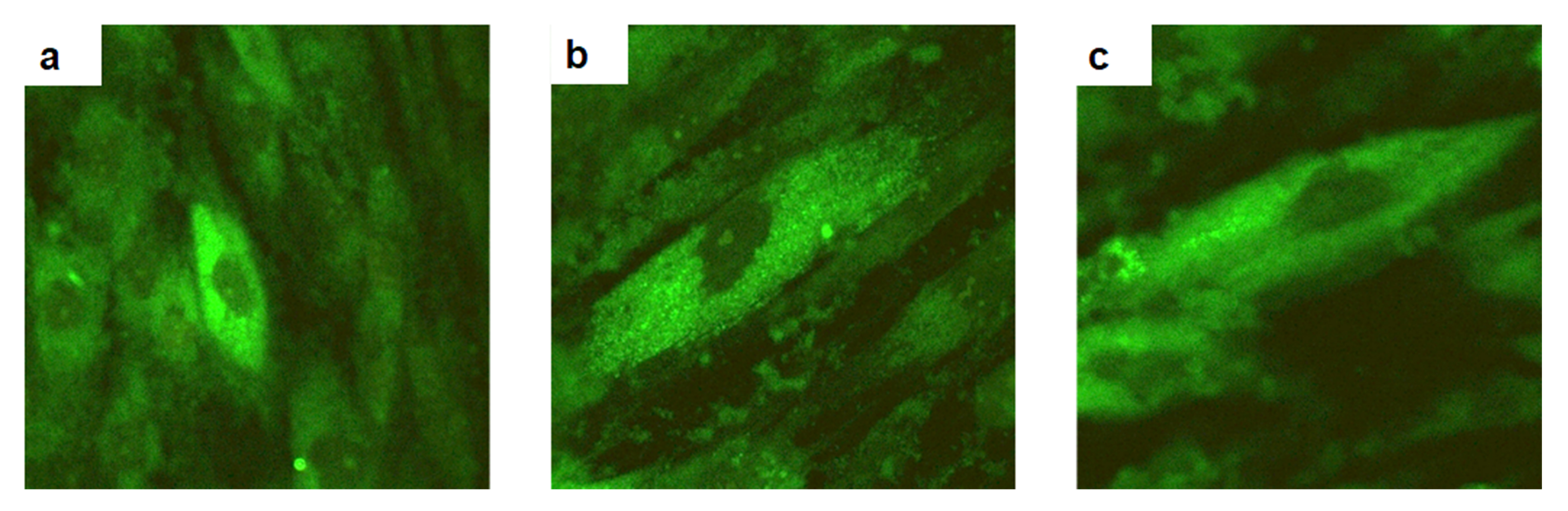 Vinculin 
expression in hDPFs. control group (a), and with Biodentine’s eluates (b) and 
with MTA’s (c). *p < 0.05 vs. control.
