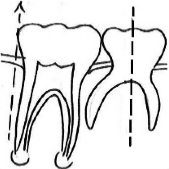 Journal of Clinical Pediatric Dentistry (JOCPD)