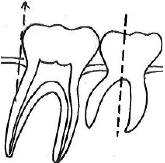 Journal of Clinical Pediatric Dentistry (JOCPD)