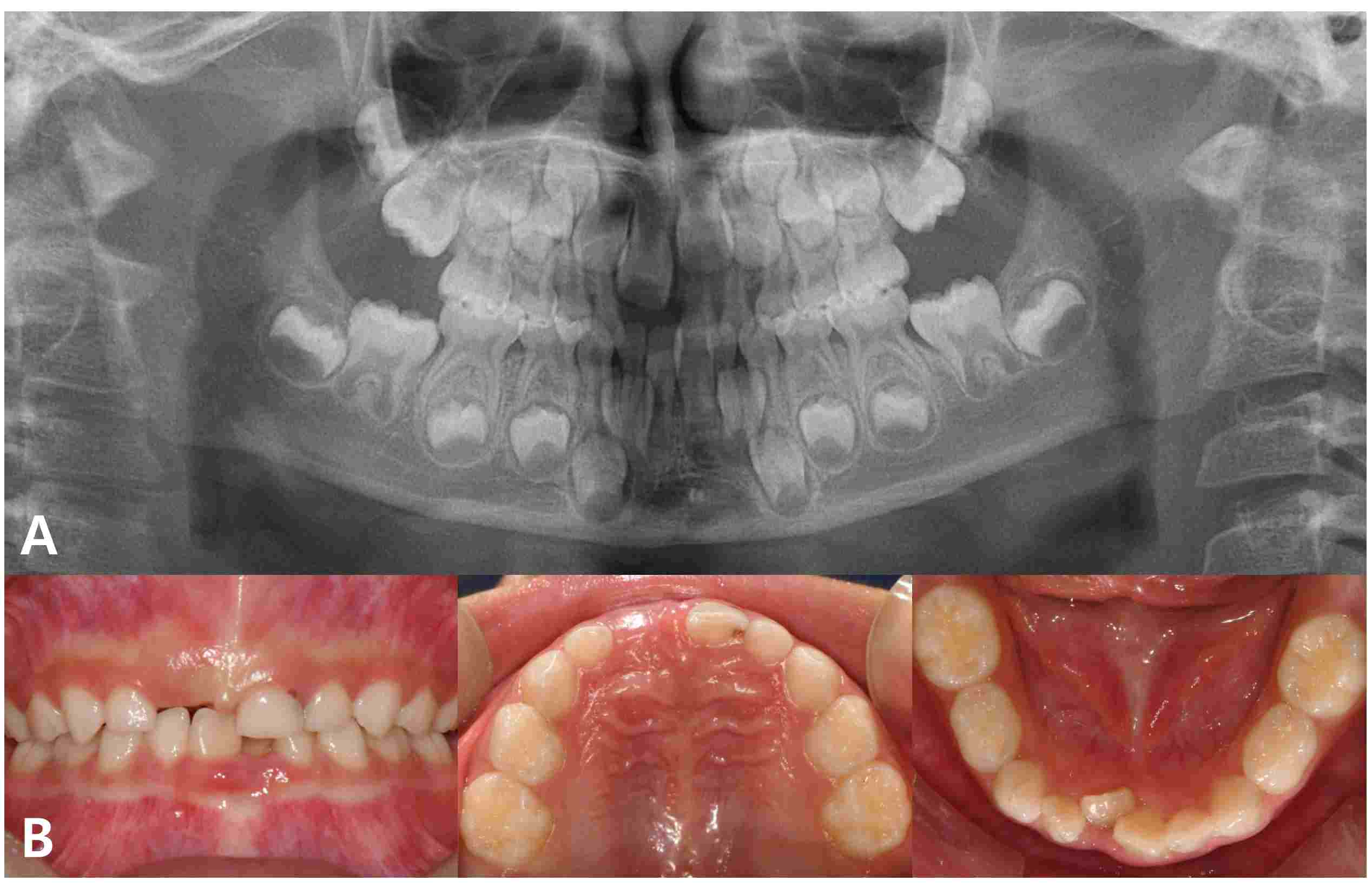 Journal of Clinical Pediatric Dentistry (JOCPD)