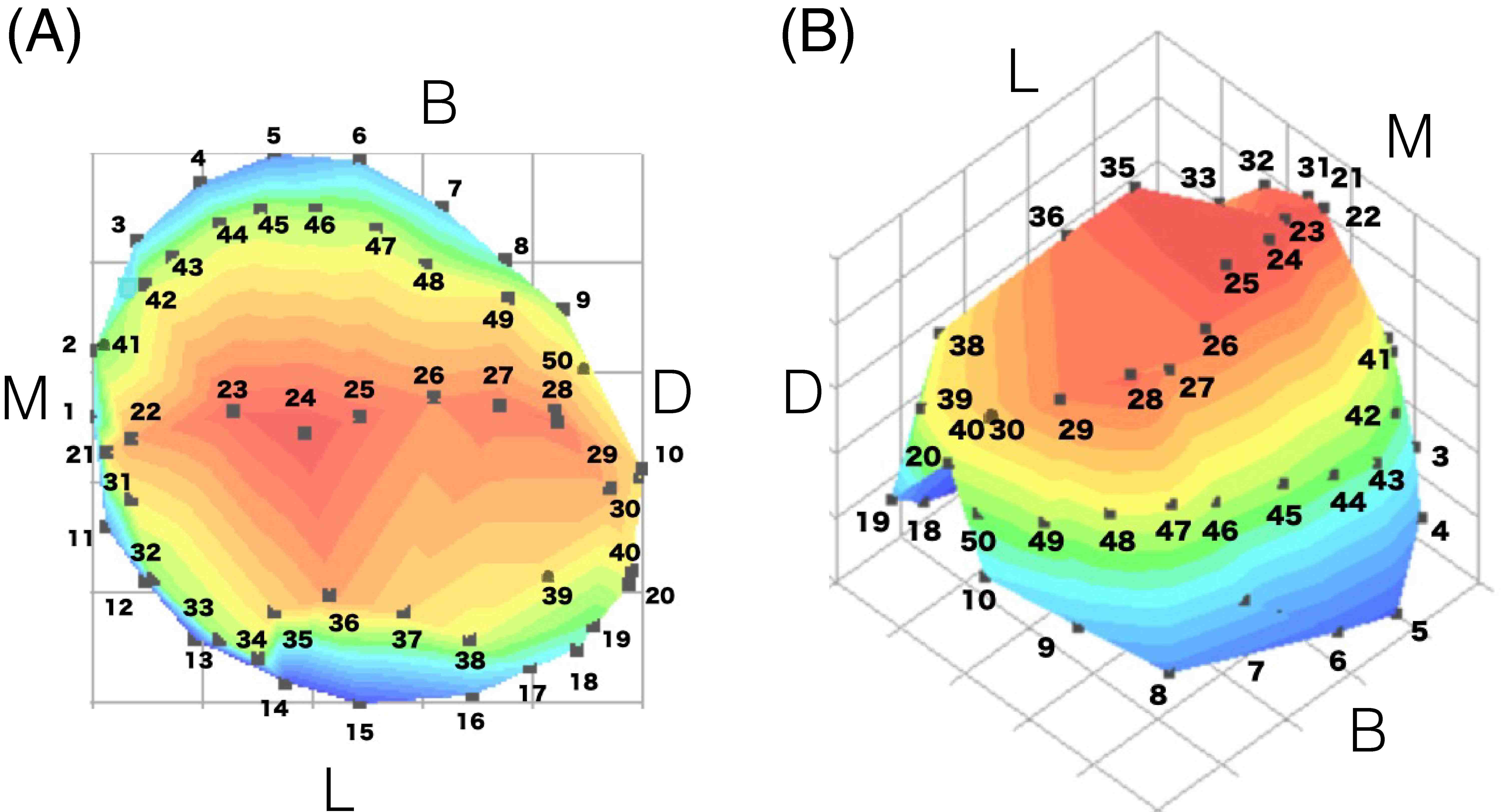 The 50 reference points on the primary first molars of a dental
stone from different perspectives. (A) The 50 reference points on the primary
first molars of a dental stone in the occlusal view (M: mesial side; D: distal
side; B: buccal side; L: lingual side). Points 1–10 present the buccal cervical
gingival line of the primary first molars; points 11–20 present the lingual
cervical gingival line; points 21–30 present the buccal marginal ridge; points
31–40 present the lingual marginal ridge; and points 41–50 present the highest
point of the buccal contour. (B) 3D model of a mandibular primary first molar
constructed using Graph-R. The black marks on the model are the reference points
for the scanning probes during 3D scanning. 3D: three-dimensional.
