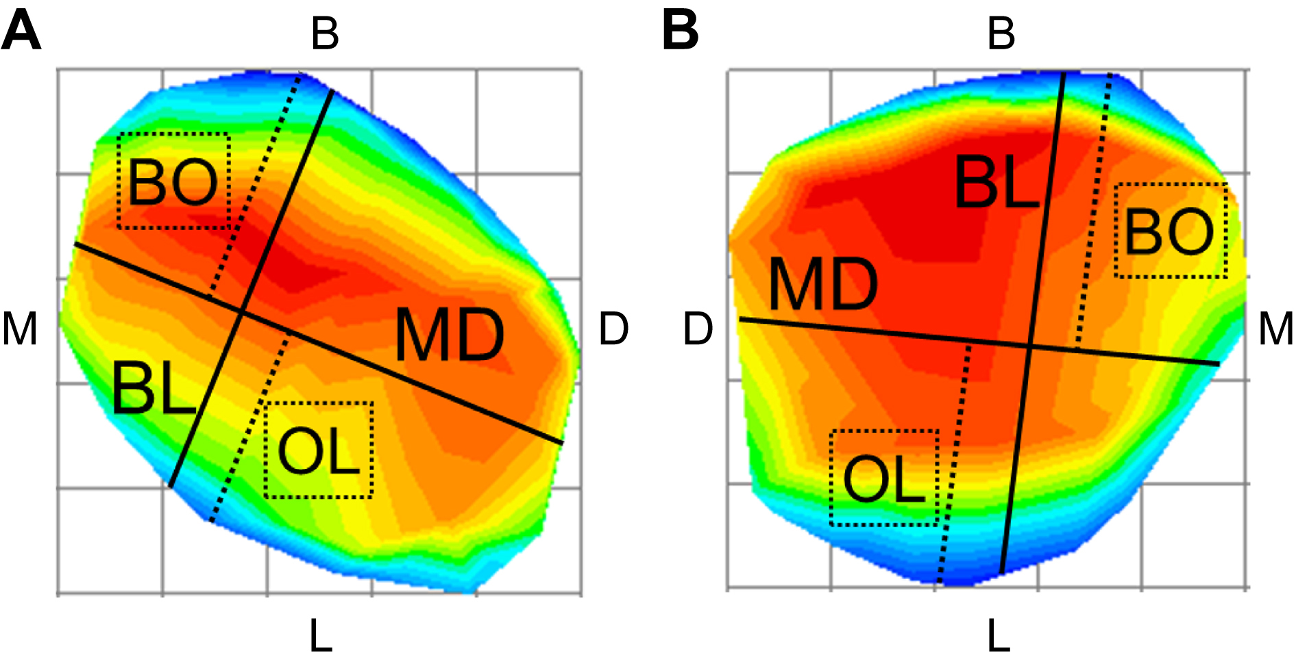Graphical representations of primary first molars from different
perspectives (M: mesial side; D: distal side; B: buccal side; L: lingual side). (A) The coordinate plane of the mandibular primary first molar viewed from the
occlusal surface. (B) Coordinate plane of the maxillary primary fist molar viewed
from the occlusal surface. BL: buccolingual distance; BO: distance between the
highest point of the buccal contour perpendicular to the MD line; MD: mesiodistal
distance; OL: distance between the highest point of the lingual contour
perpendicular to the MD line.