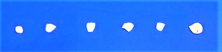 Analysis of the six samples
and pathology of the entire surface of the enamel.
