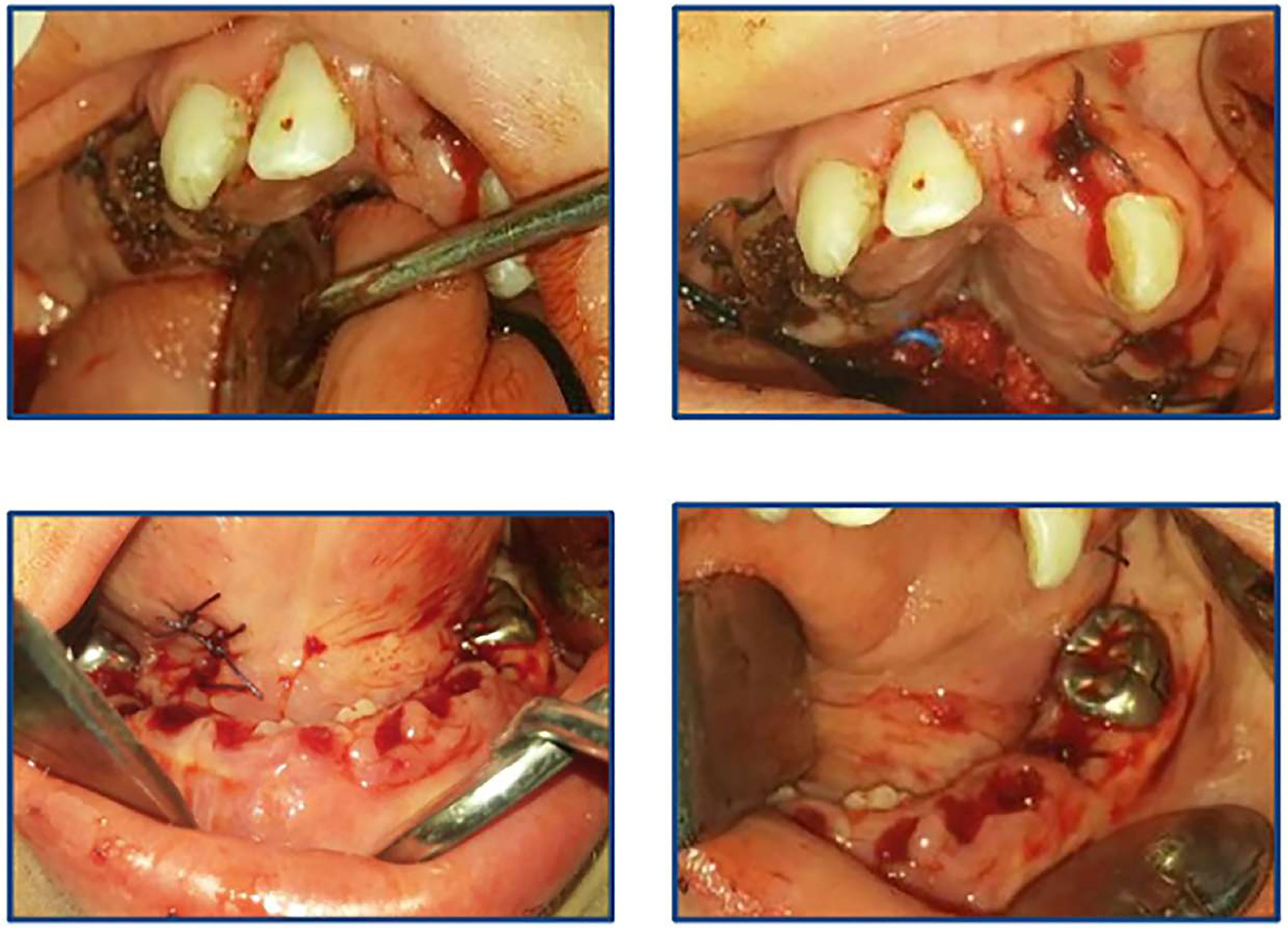 Post-treatment intraoral 
photograph of the patient.