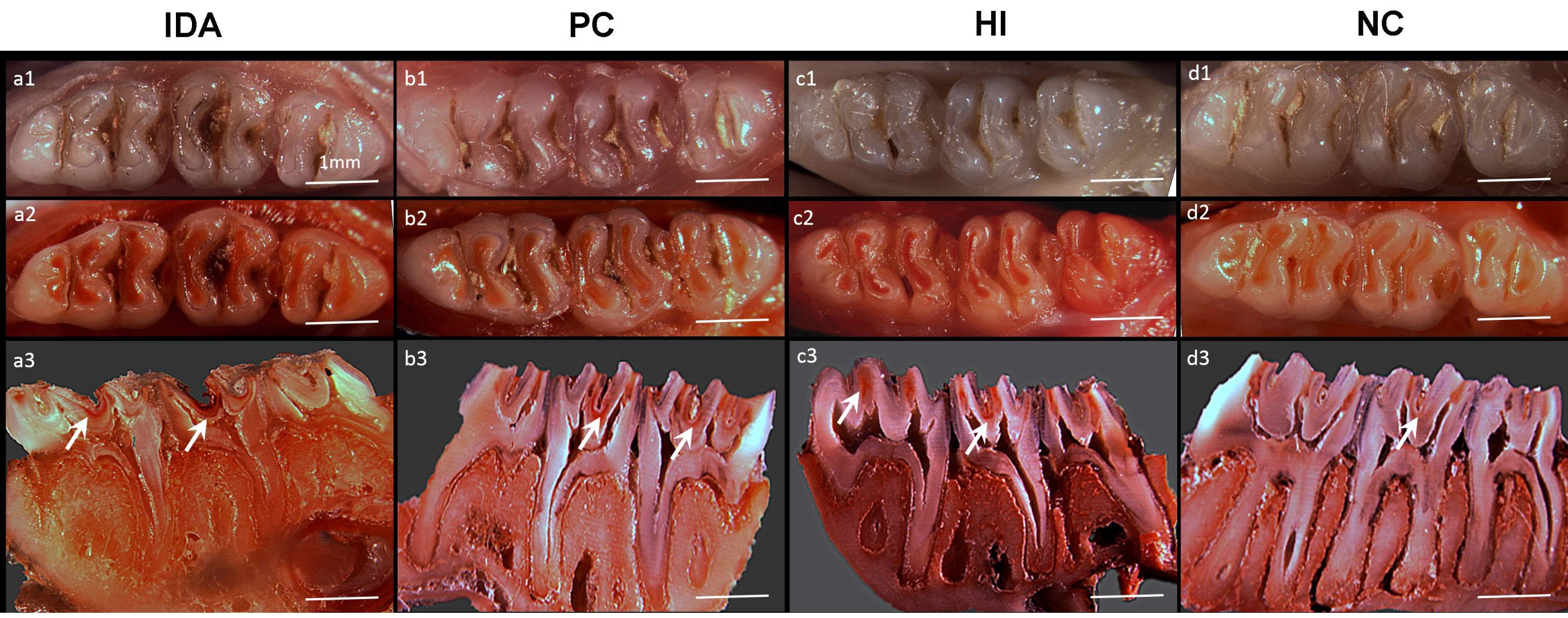 The morphology of molar caries. a, b, c and d represent the
molars in the IDA, PC, HI, and NC groups, respectively. 1, 2 and 3 represent
stereomicroscopic images of molars before staining, after staining, and after
hemisection, respectively. White arrows indicate positive sites of carious
lesions. IDA: Iron-deficiency anemia; PC: Positive control; HI: High-iron; NC:
Negative control.
