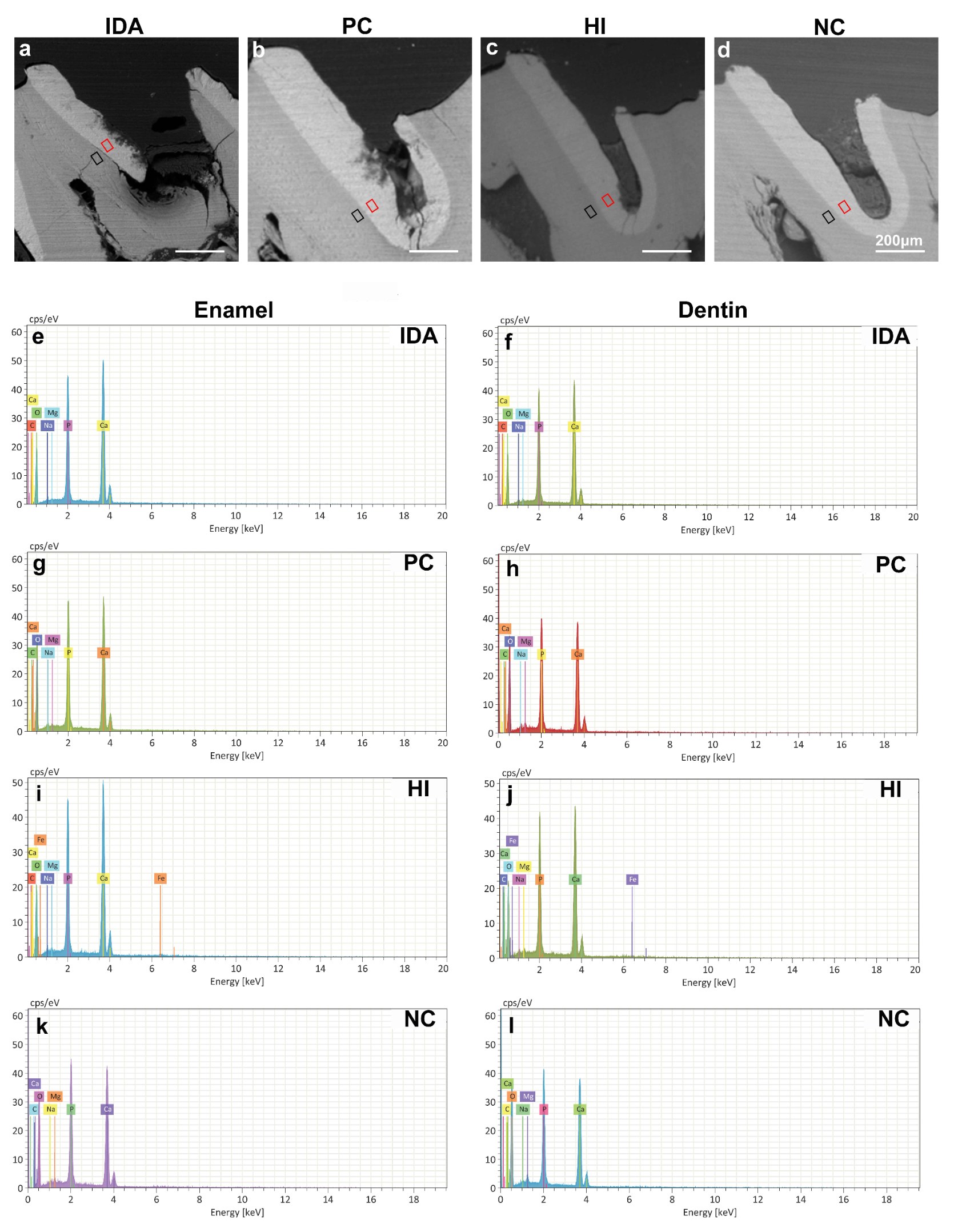 The micromorphology and elemental compositions of molar caries. a–d represent the SEM images of the molars in the IDA, PC, HI, and NC groups;
e–l represent the EDS of enamel and dentin in different groups. IDA:
Iron-deficiency anemia; PC: Positive control; HI: High-iron; NC: Negative
control.