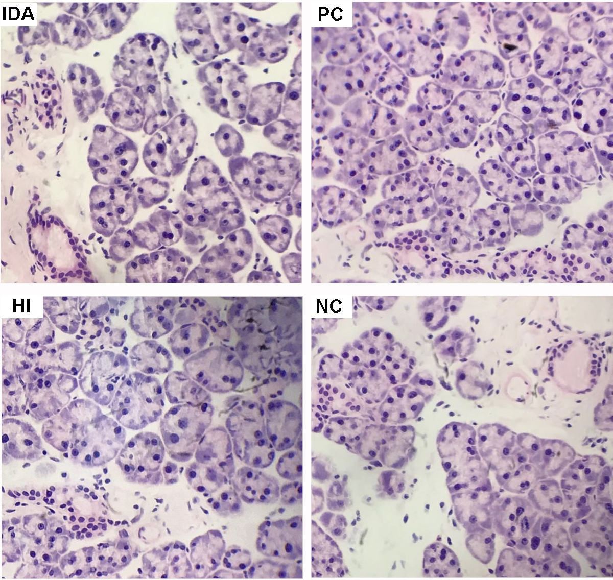 Morphological structure of the salivary glands was observed by
HE staining (×400). IDA: Iron-deficiency anemia; PC: Positive control;
HI: High-iron; NC: Negative control.