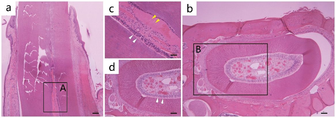 Histological appearance in
MTA group after 8 weeks. Representative photomicrographs showing (a)
longitudinal section; (b) transverse section; (c) Partially magnified image of
the A section; (d) Partially magnified image of the B section. H&E stain
×200 magnification. Arrows indicate a polarized odontoblast layer and
fresh dentin tissue.