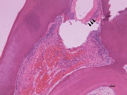 Histological appearance
in MTA group after 8 weeks. Representative photomicrographs showing calcified
bridges. H&E stain ×200 magnification. Arrows indicate normal
dentin-like tubule structures.