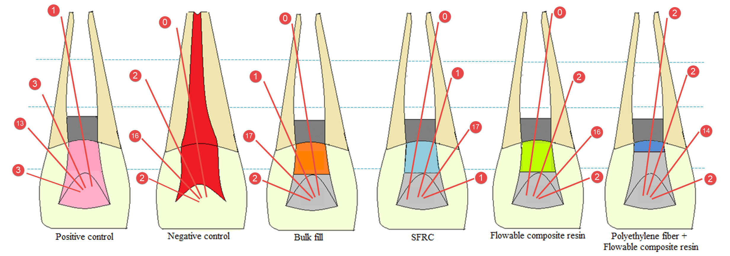 Schematic illustration of fracture locations of all the groups. SFRC: short fiber reinforced composite.