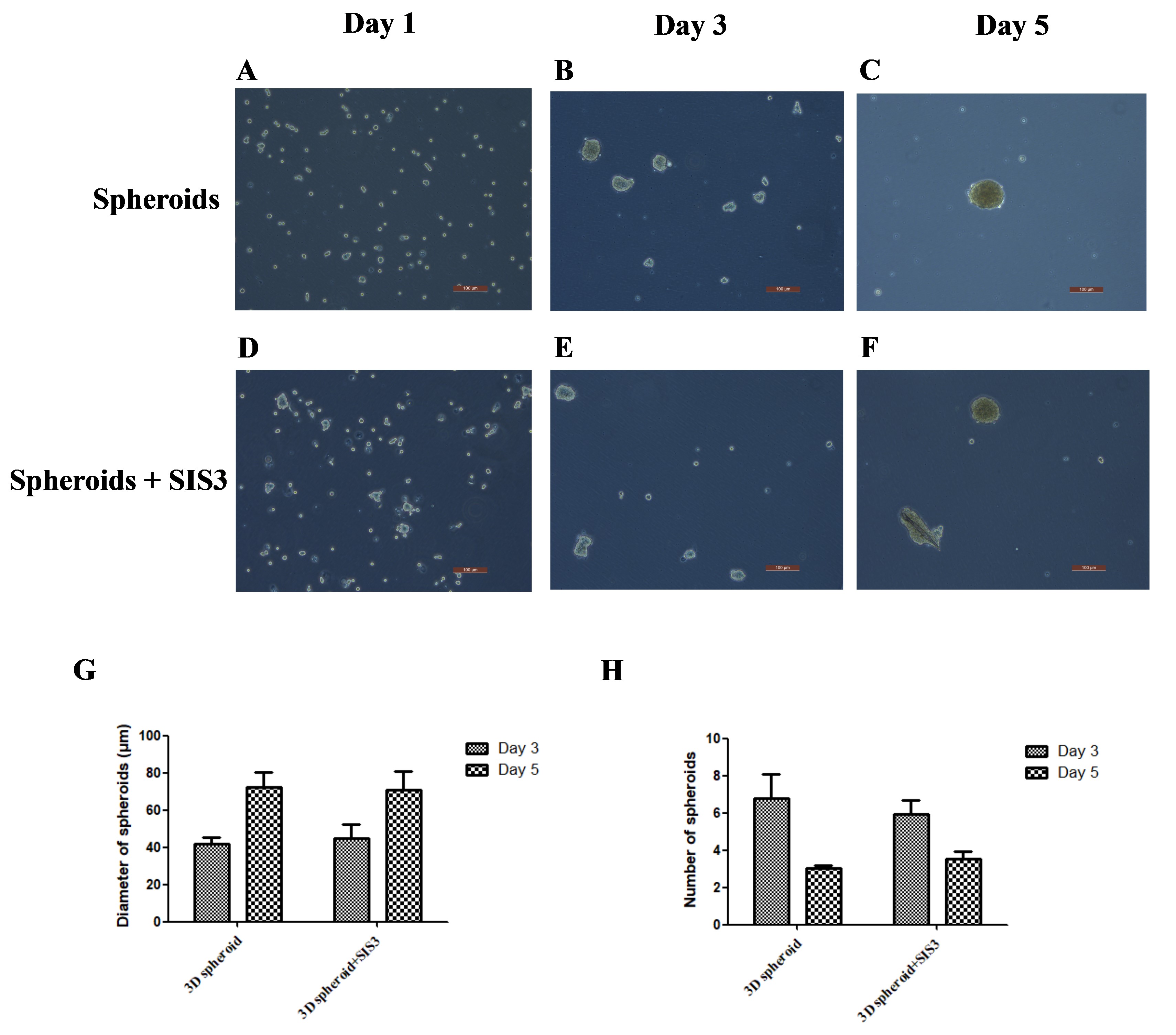 The morphologic characteristics of SHED spheroids. (A–C):
Morphology of SHED spheroids cultured in 3D spheroid formation on days 1 (A), 3
(B) and 5 (C). (D–F): Appearance of SHED spheroids cultured in 3D spheroid
formation with SIS3 on days 1 (D), 3 (E) and 5 (F). The scale bar represents 100
µm. The average diameter of spheroids increased on days 3 and 5 without
statistically significant differences in the two different groups (G). Although a
decrease in spheroid number was observed between days 3 and 5, no significant
difference was observed between the groups of 3D spheroid formation with or
without SIS3 (H). 3D: three-dimensional. SIS3: specific inhibitor of Smad3.