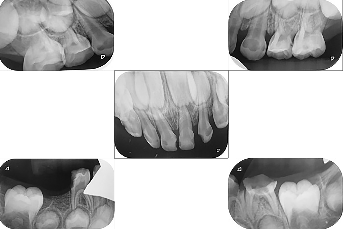 Initial radiographic images.