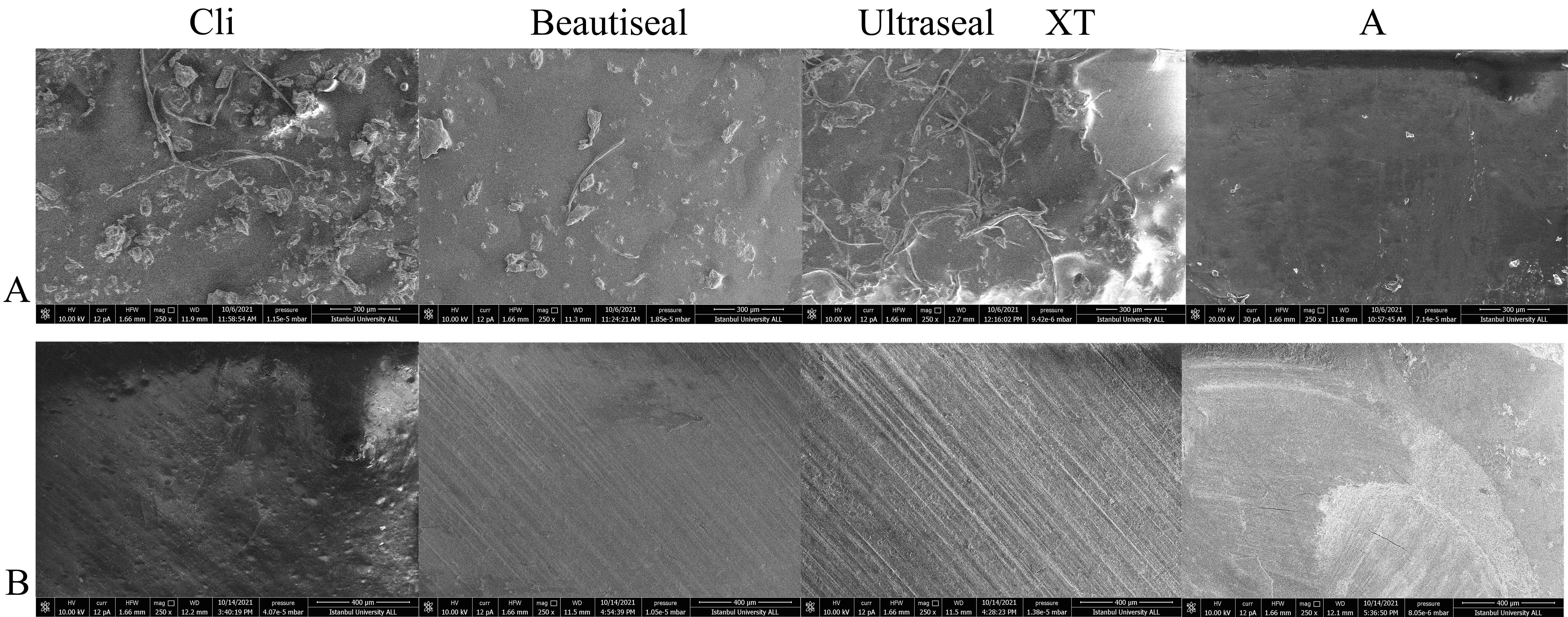 Sem Images 250×. (A) SEM images of Clinpro, Beautisealant, 
Ultraseal XT Hydro, and Aegis before the chewing process 
(250×). The smooth and homogeneous image was observed for Group 
A in the beginning. Groups C and U particles were large and heterogeneous. (B) 
SEM images of Clinpro, Beautisealant, Ultraseal XT Hydro, and Aegis after chewing 
process (250×). An irregular surface was observed after the 
chewing simulator procedure for all groups due to the particles displacement by 
vertical and horizontal forces. The cracks significantly increased in the samples 
of Groups A and C, however they could not be clearly observed in Groups B and U 
after the chewing simulator process.