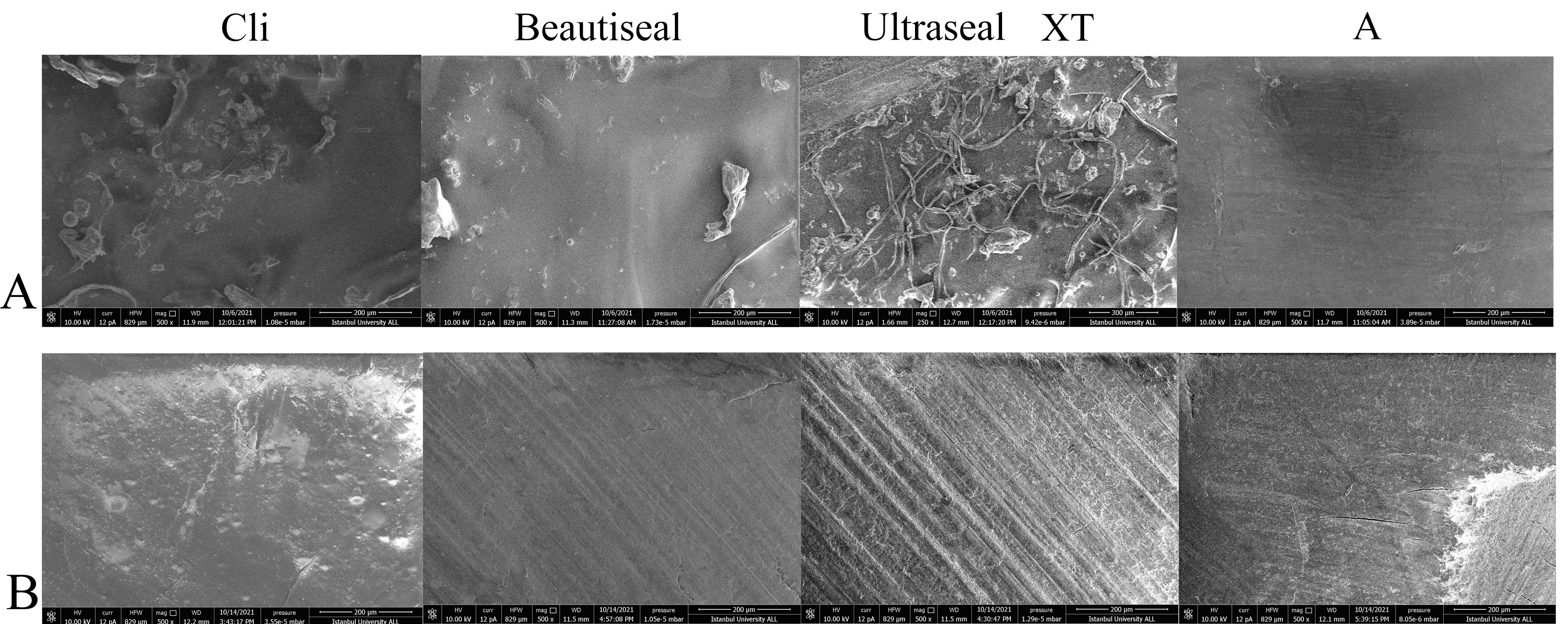 Sem images 500×. (A) SEM images of Clinpro, Beautisealant, 
Ultraseal XT Hydro, and Aegis before the chewing process 
(500×). Group A exhibited the smooth and homogeneous image in 
the beginning while Groups C and U had shown large and heterogeneous particles. 
(B) SEM images of Clinpro, Beautisealant, Ultraseal XT Hydro, and Aegis after 
chewing process (500×). All groups showed irregular surface 
after the chewing simulator procedure due to the particles displacement by 
vertical and horizontal forces. Samples from Groups A and C exhibited significant 
increase in crack appearance, however, it was not clearly observed in Groups B 
and U after the chewing simulator process.