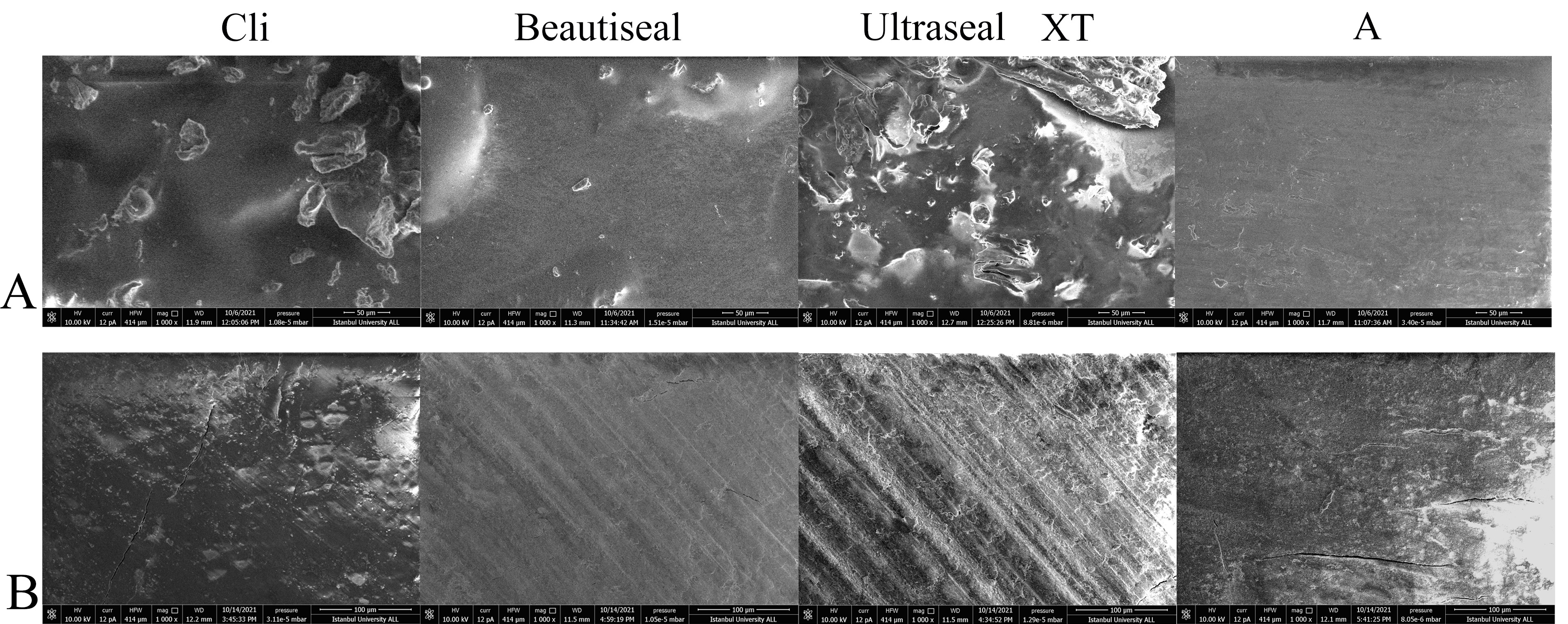 Sem images 1000×. (A) SEM images of Clinpro, Beautisealant, 
Ultraseal XT Hydro, and Aegis before the chewing process 
(1000×). Group A exhibited the smooth and homogeneous image in 
the beginning while Groups C and U had shown large and heterogeneous particles. 
(B) SEM images of Clinpro, Beautisealant, Ultraseal XT Hydro, and Aegis after the 
chewing process (1000×). All groups showed irregular surface 
after the chewing simulator procedure due to the particles displacement by 
vertical and horizontal forces. Samples from Groups A and C exhibited significant 
increase in cracks, however they were not clearly observed in Groups B and U 
after the chewing simulator process.