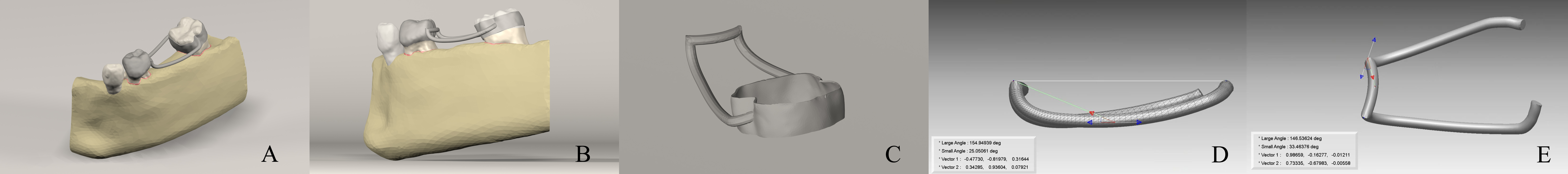 Generated 3D simulation model of test model 3. (A) Curved arm
type of FSM. (B) Sagittal view of FSM. (C) Render Image of Test Model 3. (D)
Sagittal view of the angles of the curved arm type of FSM. (E) Horizontal view of
the angles of the curved arm type of FSM.