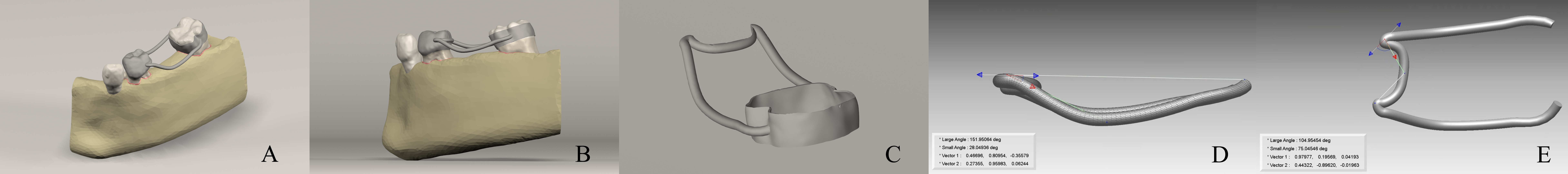 Generated 3D simulation model of test model 4. (A) Curved and
surround-type arms of FSM. (B) Sagittal view of FSM. (C) Render Image of Test
Model 4. (D) Sagittal view of the angles of the curved and surround arm type of
FSM. (E) Horizontal view of the angles of the curved and surround arm type of
FSM.