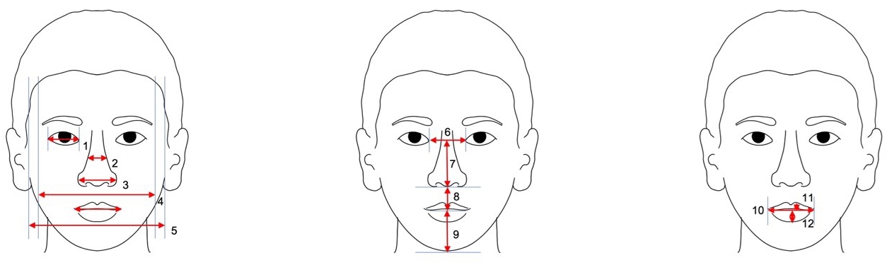 Frontal measurements. A schematic diagram of 12 linear measurements made on frontal photographs is presented.