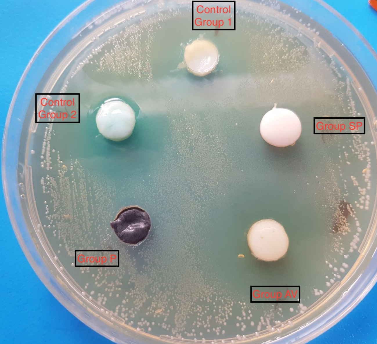 A culture plate with wells overlaid with S. mutans and 
inhibitory halo for samples of 1 Group AV, 2 Group P, 3 Control Group 2, and 4 
Control Group 1 and 5 Group SP.