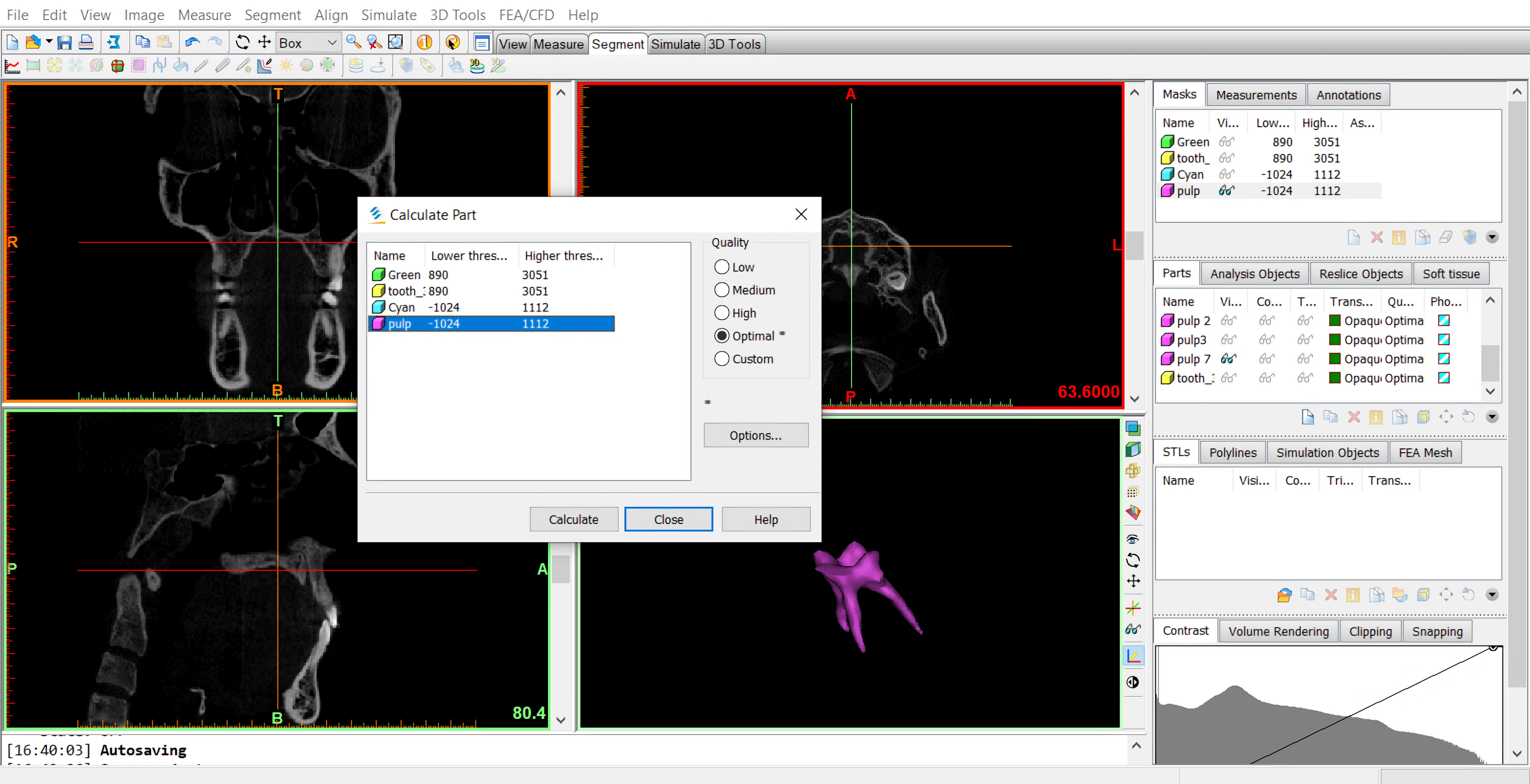 Creation of a three-dimensional (3D) image (3D pulp image).