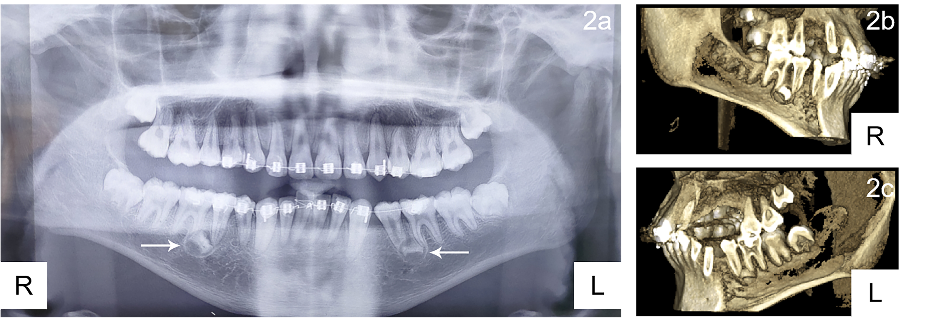 Panoramic X-ray. ES? - New User Help - Living with Eagle