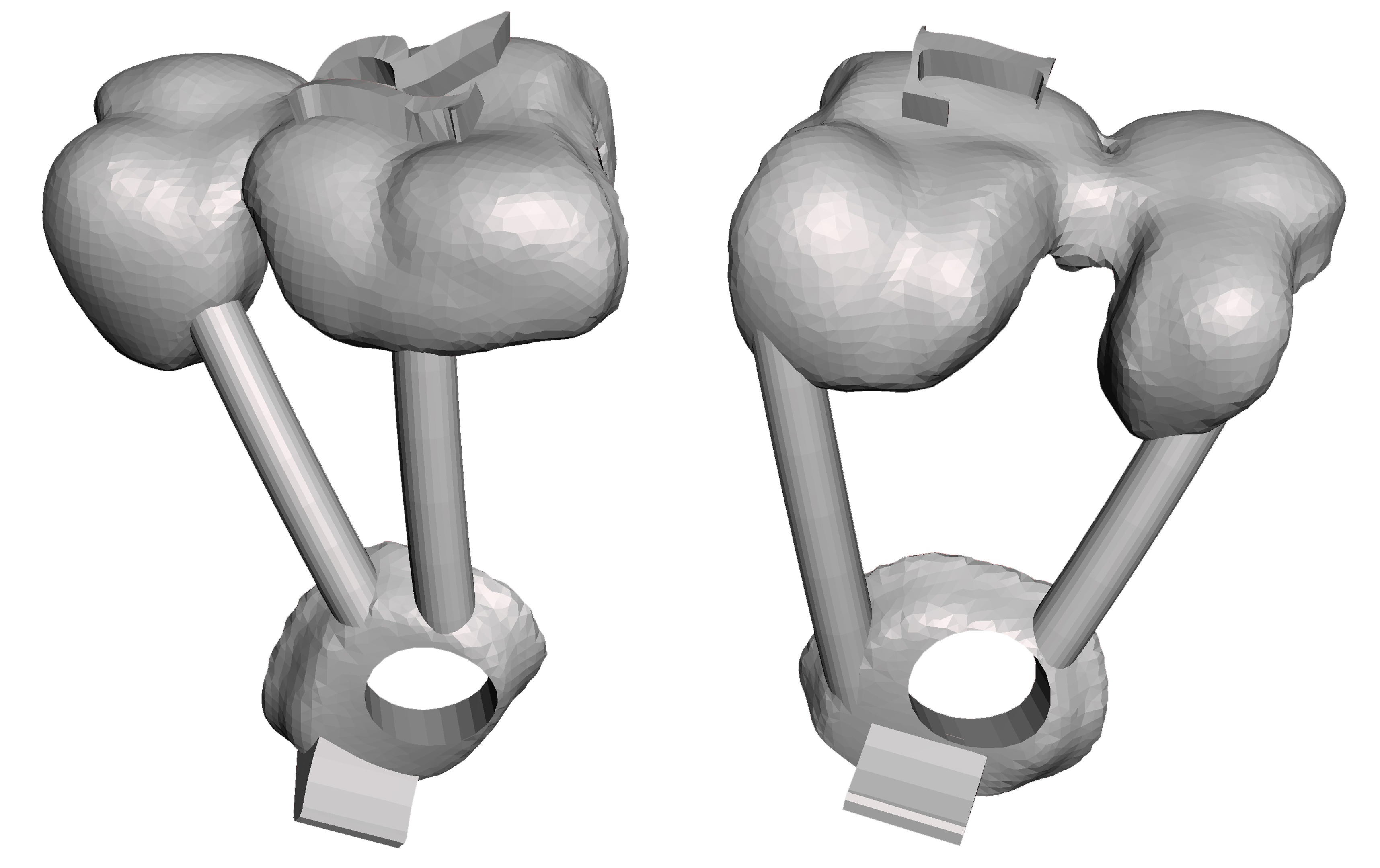 3D positioning of the guide
template.