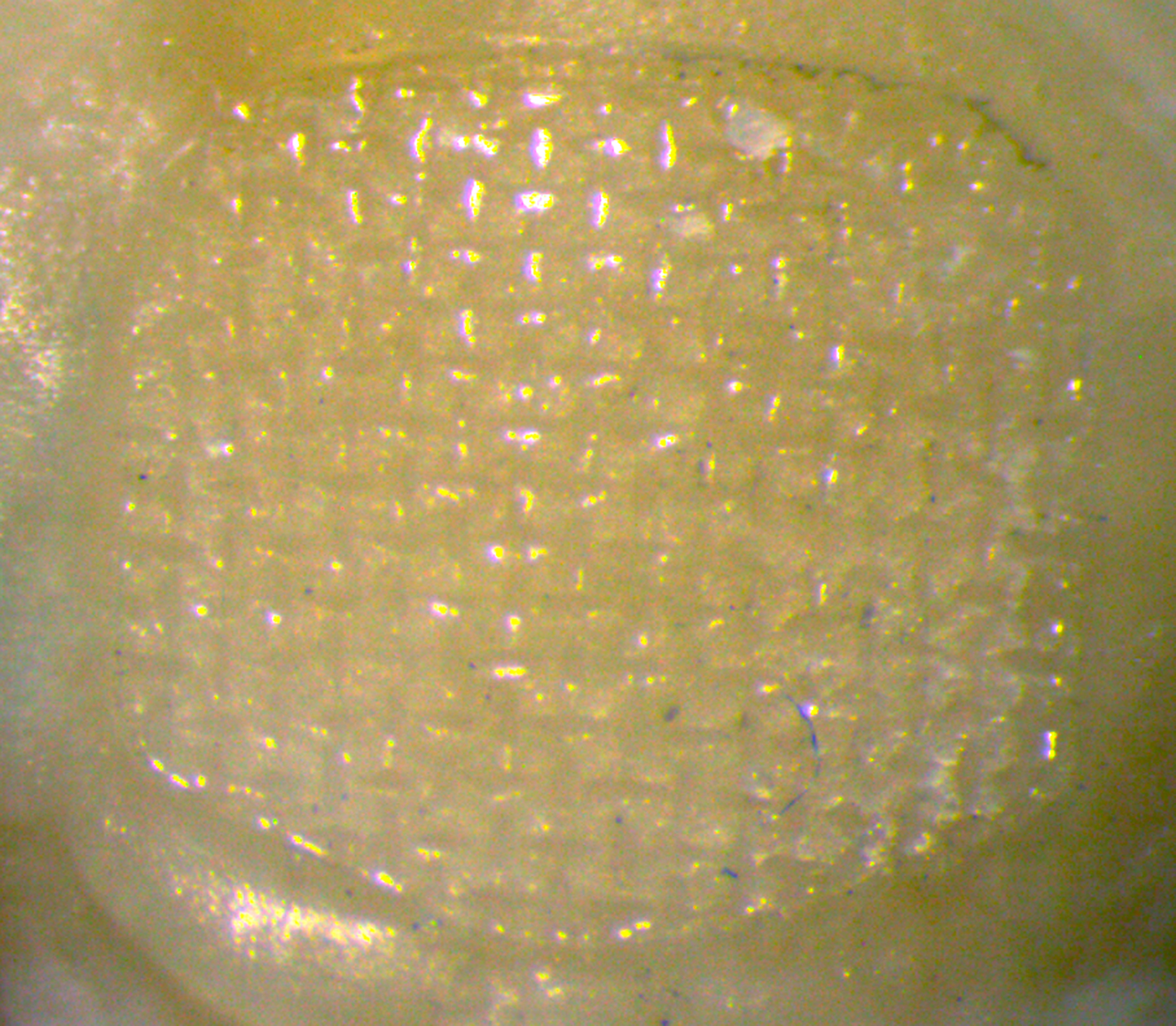 Representative multi-focus image of adhesive remnants (100%) on
a typical tooth in the control group.