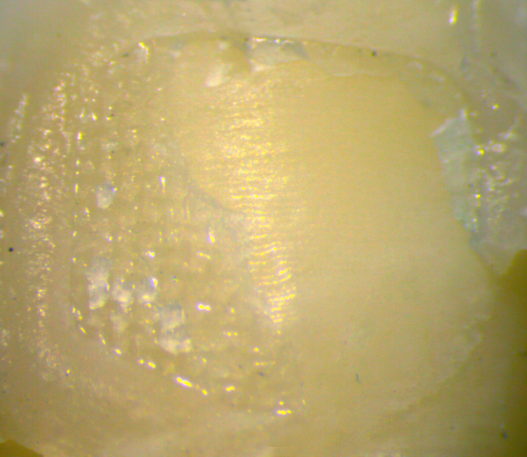 Representative multi-focus image of adhesive remnants (25–49%)
on a typical tooth in the 15-s cooling time group.
